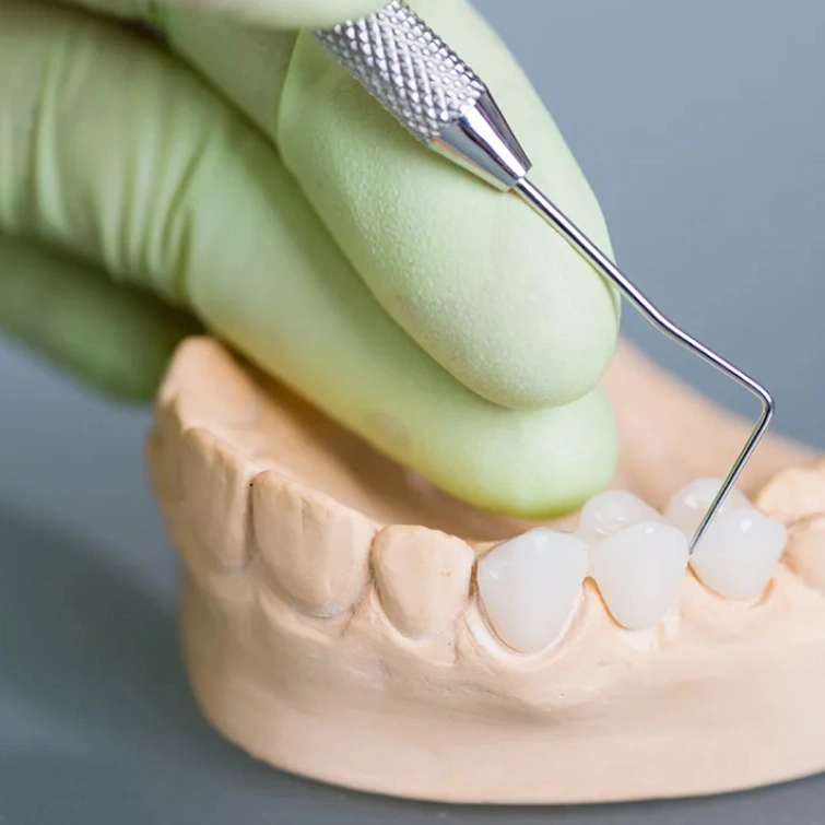 dental bridges in brookline