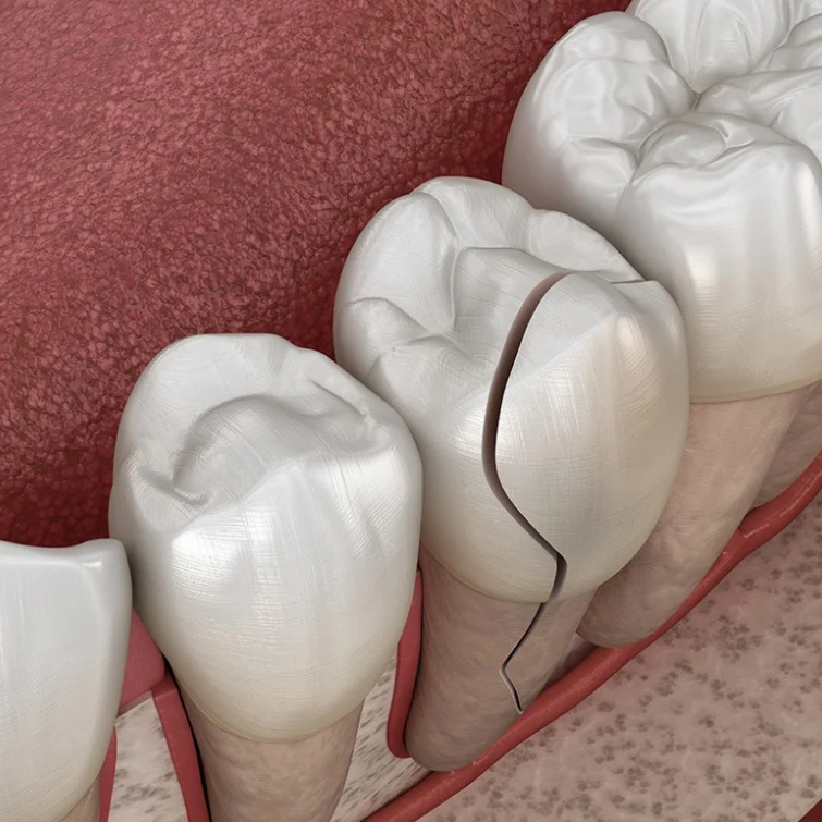 emergency dentist brookline