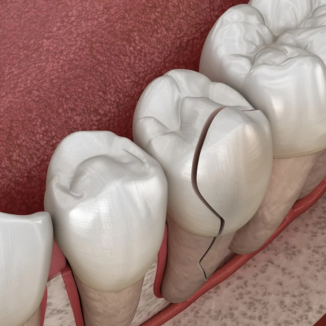 preventive dental care Brookline