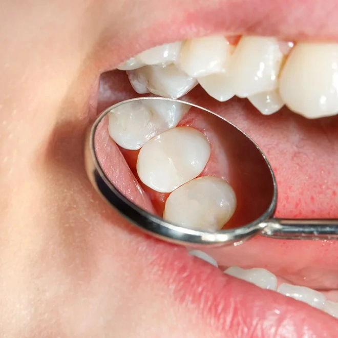 restorative dentist brookline