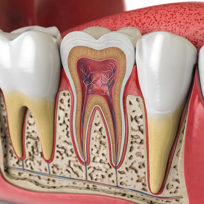 restorative root canal therapy brookline