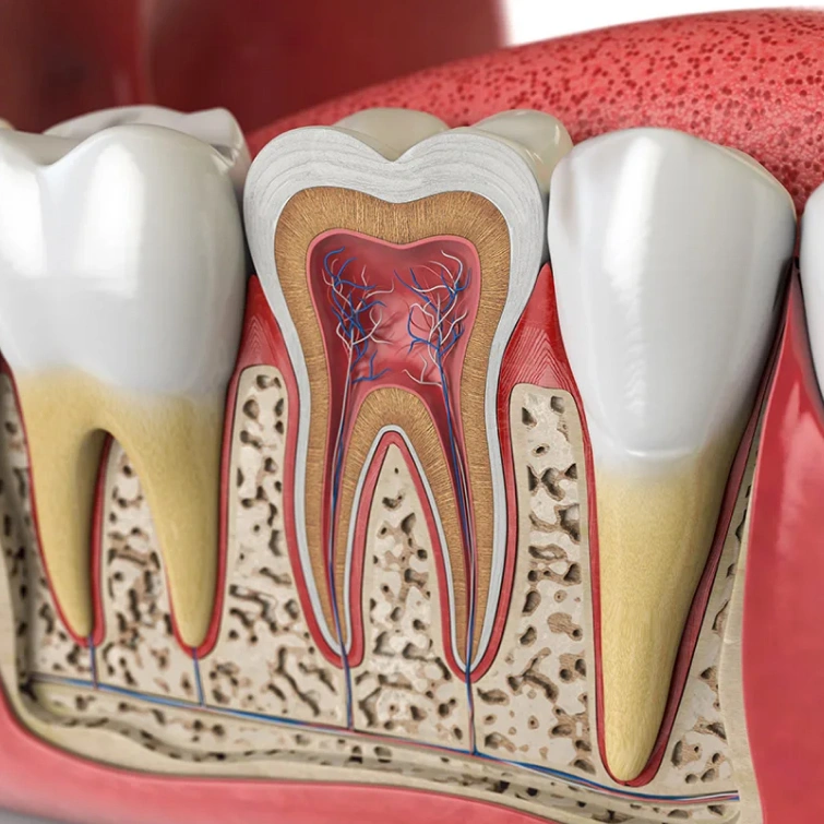 root canal in brookline