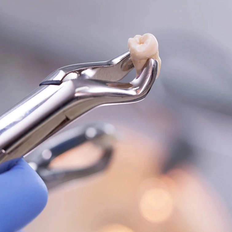 tooth extraction in brookline