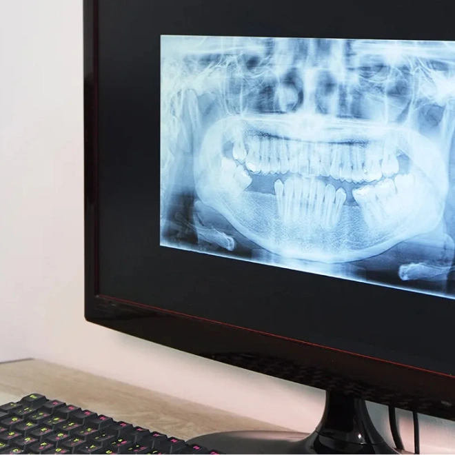 Preventive Dentistry in Brookline